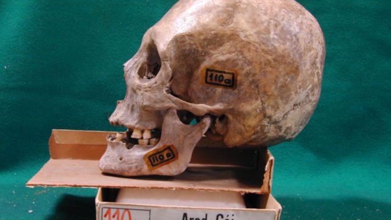 A hun ifjú koponyáját mesterségesen torzították